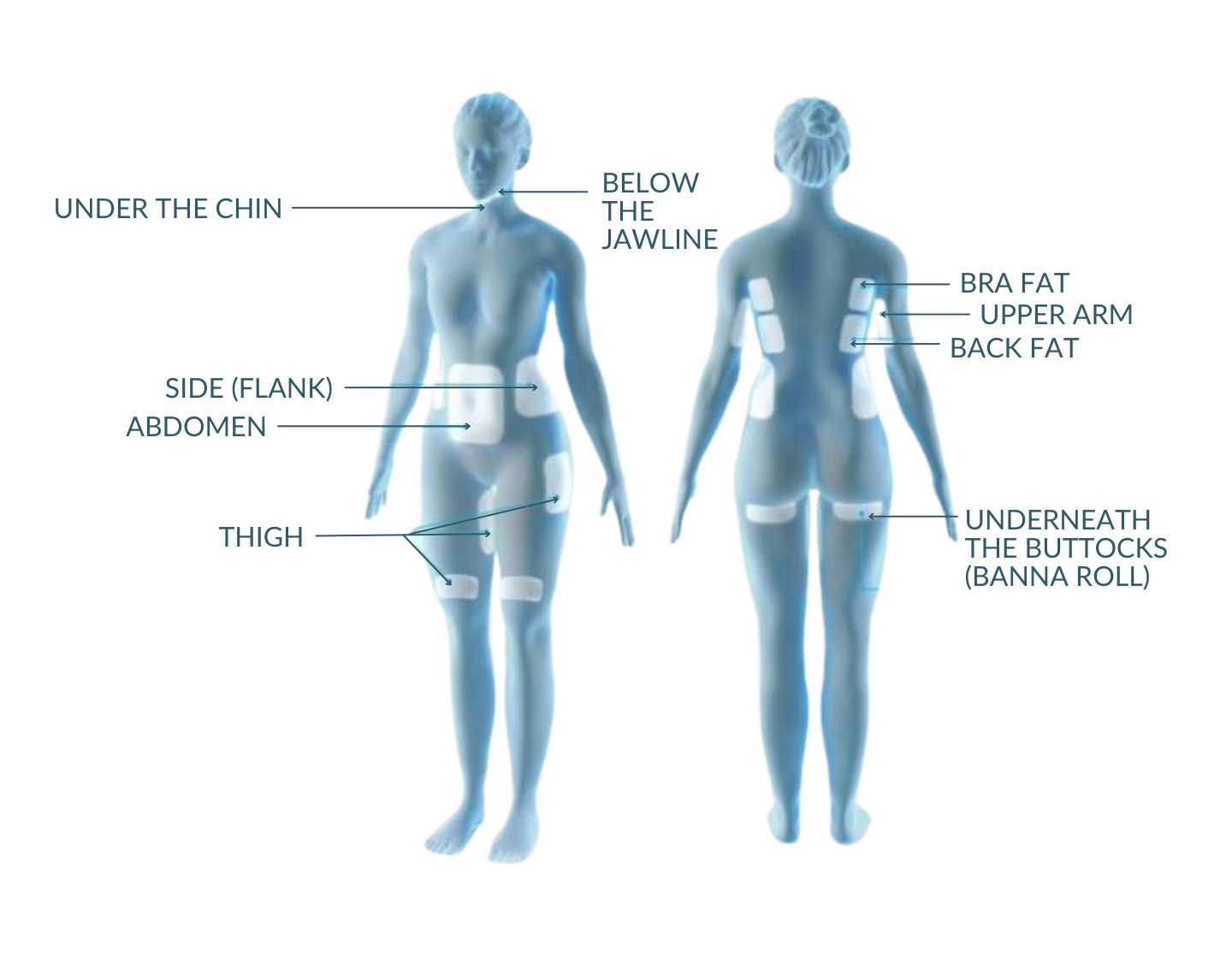 coolsculpting-treatment-areas-hilton-head-island-sc-1 coolsculpting-treatment-areas-hilton-head-island-sc-1