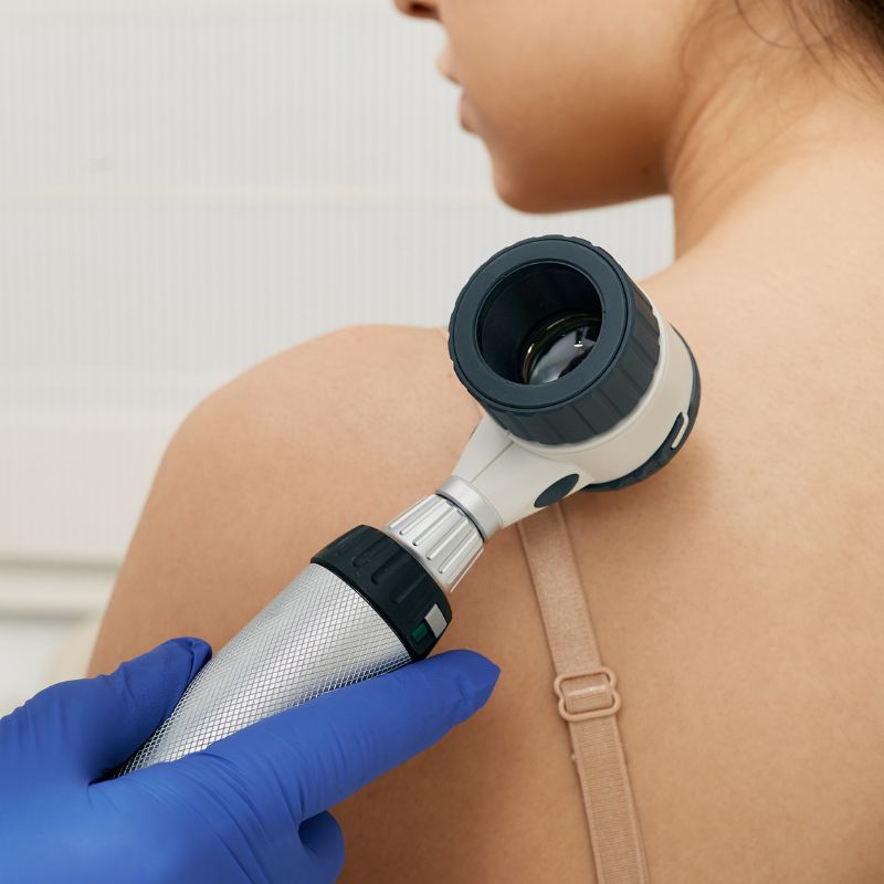 skin-cancer-surgery-hilton-head-img1 skin-cancer-surgery-hilton-head-img1